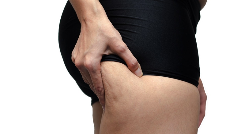 Can You Make Cellulite ‘Look’ Better