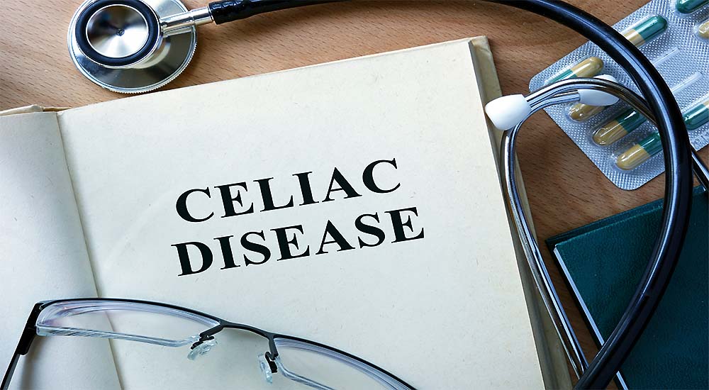 How to Interpret Confusing or Misleading Celiac Disease Research