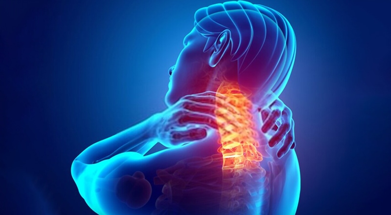 How Sustained Contraction of Your Shoulder Muscles Can Lead to Neck Pain,  Shoulder Pain and Thoracic Outlet Syndrome - Thoracic Outlet Syndrome