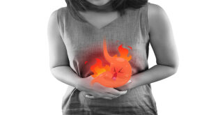Heartburn a symptom of hiatal hernia