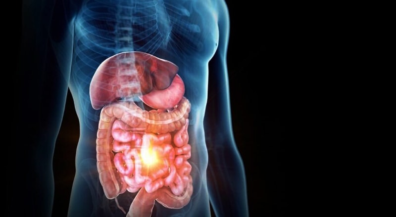 What is a Leaky Gut?