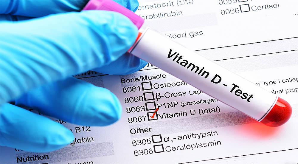 Your Vitamin D Status and Reducing Illness Risk